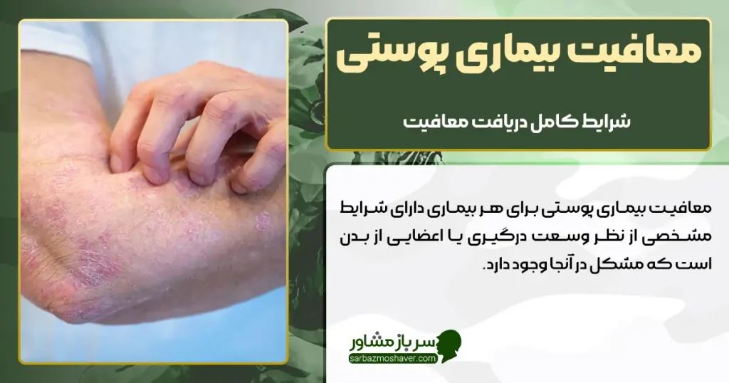 معافیت بیماری پوستی + شرایط کامل دریافت
