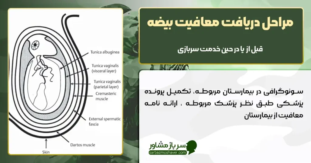 مراحل دریافت معافیت بیضه
