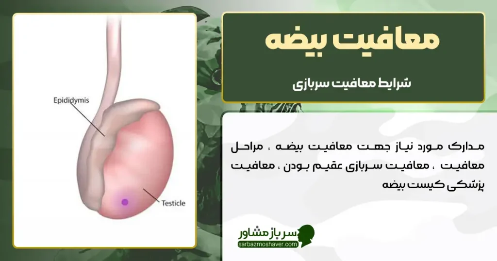 معافیت بیضه + شرایط و مدارک لازم برای دریافت معافیت