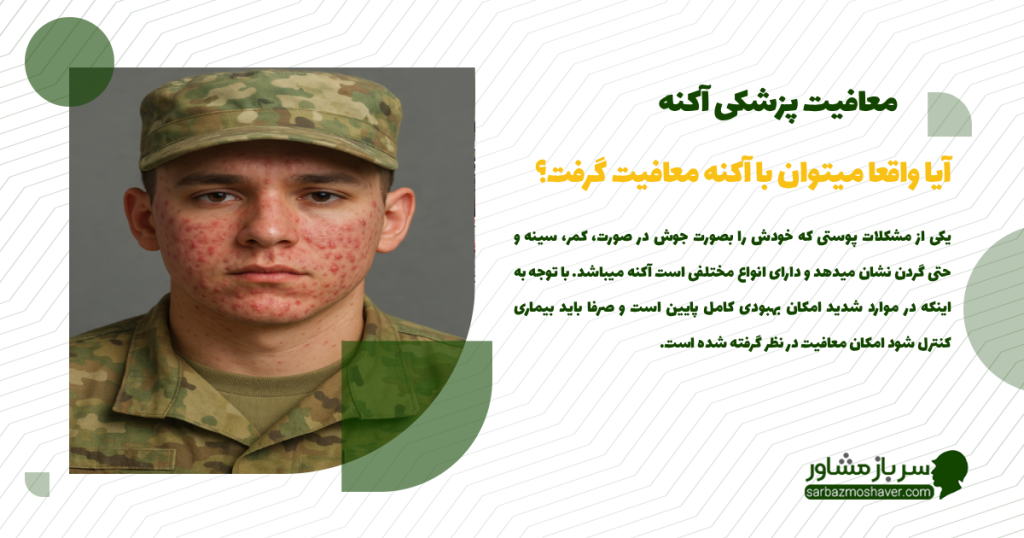 معافیت آکنه