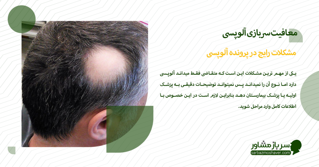 مشکلات رایج در پرونده آلوپسی