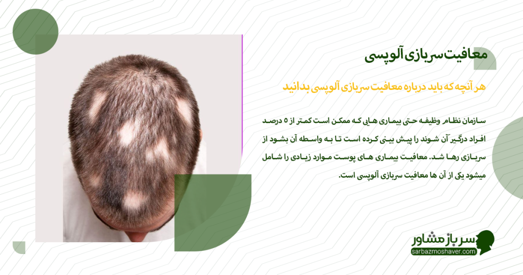 هر چه باید درباره معافیت سربازی آلوپسی بدانید