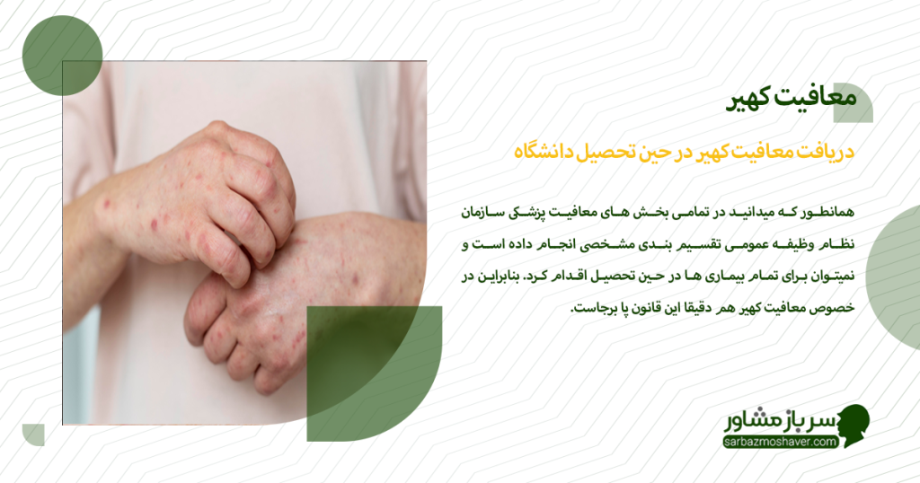 دریافت معافیت کهیر در حین تحصیل دانشگاه