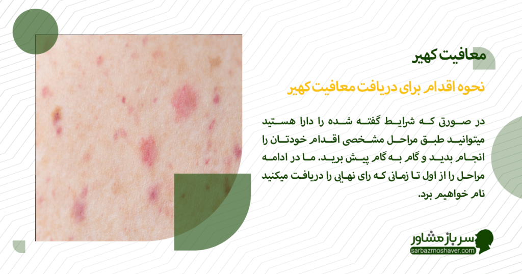 نحوه اقدام برای دریافت معافیت کهیر