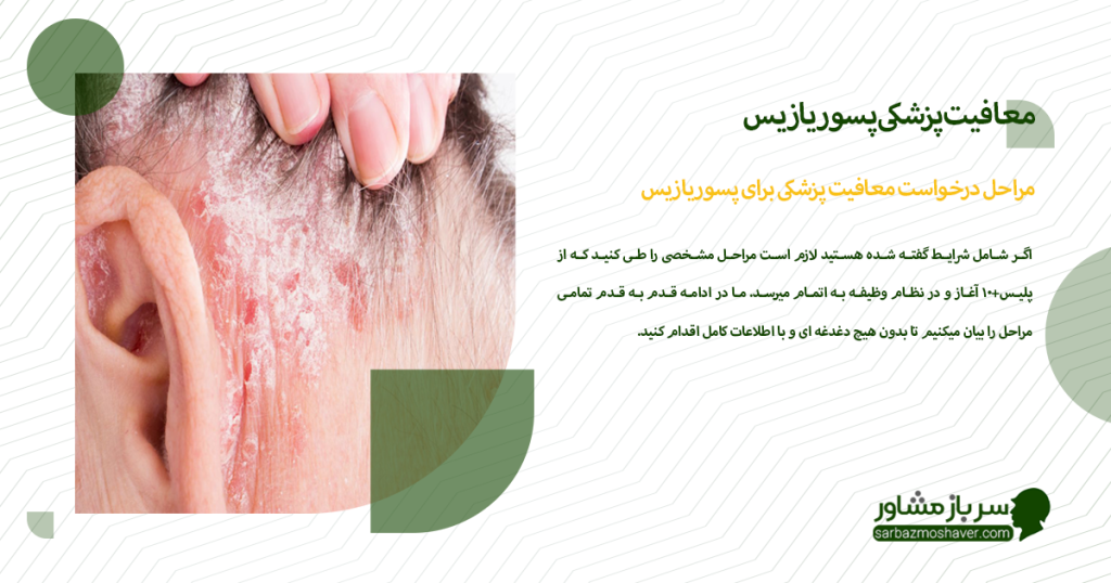 مراحل درخواست معافیت پزشکی برای پسوریازیس