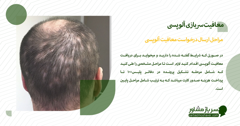 مراحل ارسال درخواست معافیت آلوپسی