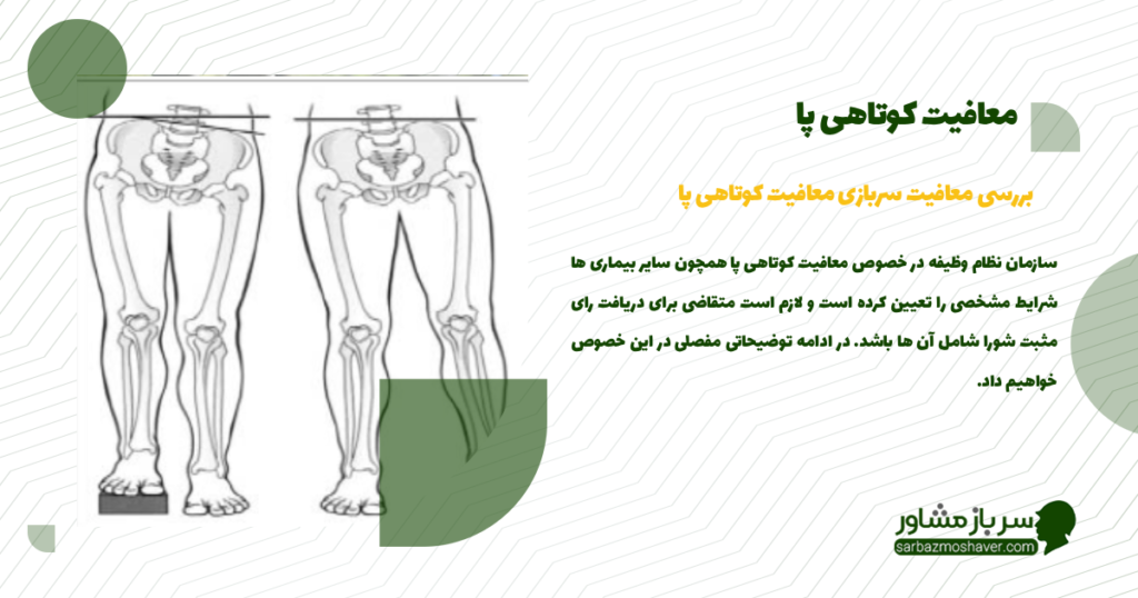 معافیت کوتاهی پا