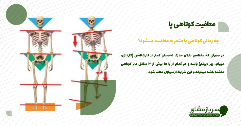 چه زمانی کوتاهی پا منجر به معافیت میشود؟