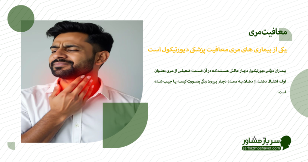 یکی از بیماری های مری معافیت پزشکی دیورتیکول است