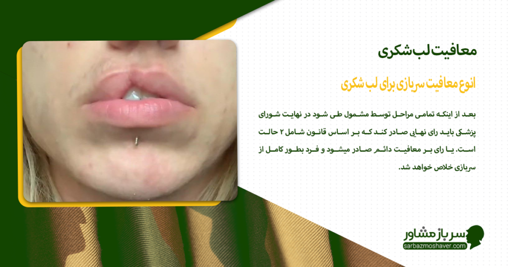 انوع معافیت سربازی برای لب شکری