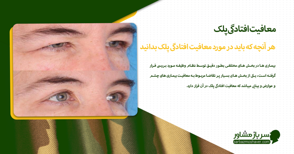 هر آنچه که باید در مورد معافیت افتادگی پلک بدانید