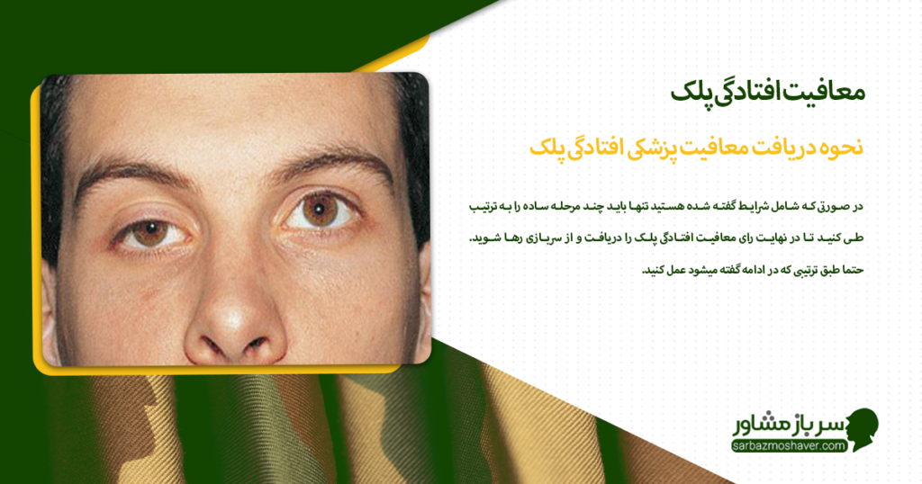 نحوه دریافت معافیت پزشکی افتادگی پلک