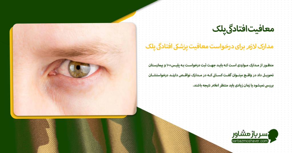 مدارک لازم برای درخواست معافیت پزشکی افتادگی پلک